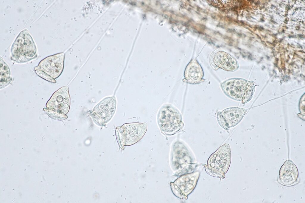 Microscopic view of Vorticella ciliates